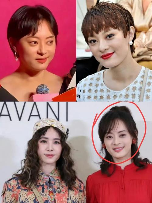 2025新澳门彩历史记录和孙俪唇下痣没了与孙俪嘴唇的痣